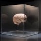 Jak długo mózg jest aktywny po śmierci? Nowe badanie zwraca uwagę na depolaryzację