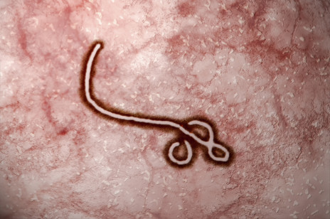 Koniec eboli w Liberii! Władze kraju planują ogłosić zakończenie epidemii