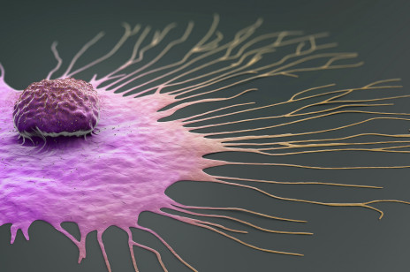 Odkryto gen odpowiedzialny za jeden z najbardziej śmiercionośnych typów raka piersi