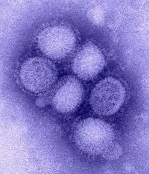 800px-H1N1_influenza_virus