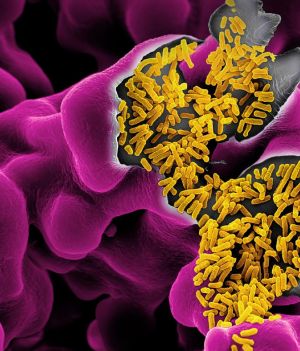 Escherichia coli, żółte pręciki skupione na fioletowym podłożu, mogą powodować zatrucia pokarmowe, ale większość szczepów jest nie tylko nieszkodliwa, ale także pożyteczna (Photographs by Martin Oeggerli)
