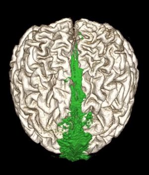 Jak działa kanalizacja w naszym mózgu? Naukowcy w końcu szczegółowo zbadali układ limfatyczny mózgu (fot. Dr. Onder Albayram, Medical University of South Carolina)