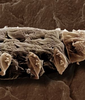 Na twojej twarzy żyją mikroskopijne roztocza. Są pasożytami, ale chcą zostać twoimi przyjaciółmi (fot. Getty Images)