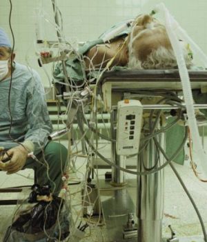 Zbigniew Religa po raz pierwszy pomyślnie przeszczepił serce pacjentowi. To zdjęcie przeszło do historii