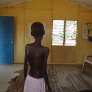 Tragedia w Sudanie Południowym. Polska misja humanitarna PCPM alarmuje
