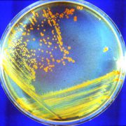 Hodowla bakterii Conana (fot. Michael J. Daly/USU)
