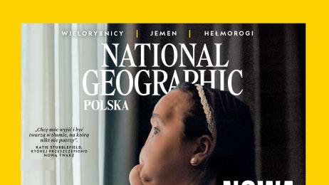 „Nowa twarz Katie”: National Geographic publikuje reportaż o najmłodszej w USA pacjentce, która otrzymała całkowity przeszczep twarzy.