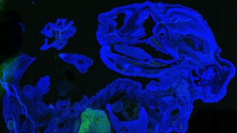 Miliony ludzkich komórek w mysim embrionie fot. Zhixing Hu