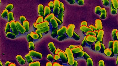 Bakteria Yersinia pestis wywołująca dżumę