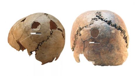 Na czaszkach ofiar znaleziono ślady śmiertelnych ciosów (fot. M. Novak, copyright Institute for Anthropological Research)