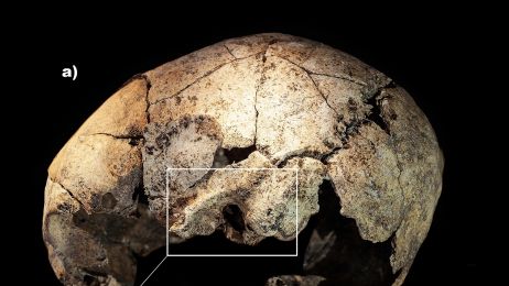 czaszka sprzed 5300 lat