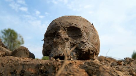 W Ameryce Północnej operowano czaszki przynajmniej 3 tys. lat temu. Co wiemy o najstarszym pacjencie?