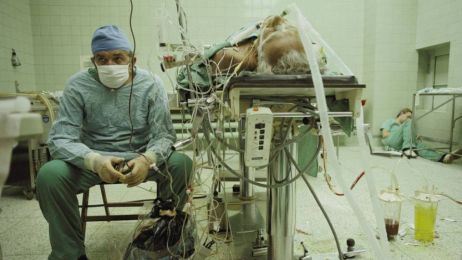 Zbigniew Religa po raz pierwszy pomyślnie przeszczepił serce pacjentowi. To zdjęcie przeszło do historii
