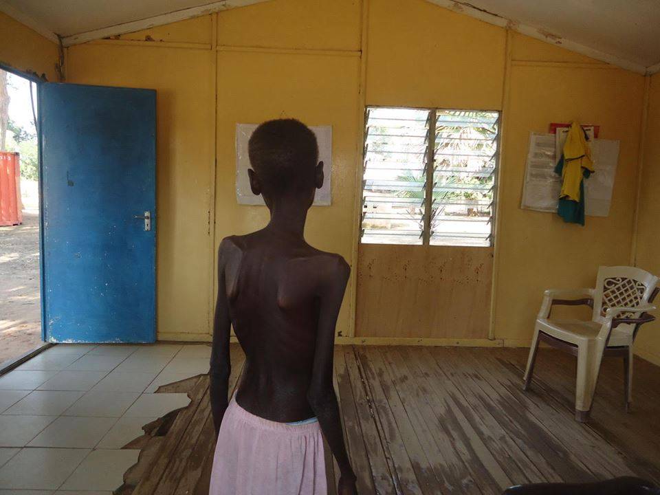 Tragedia w Sudanie Południowym. Polska misja humanitarna PCPM alarmuje