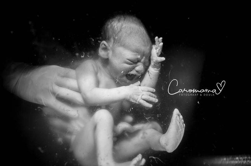 Birth Photography Image Competition 2018. Wyróżnienie: Podwodny krzyk