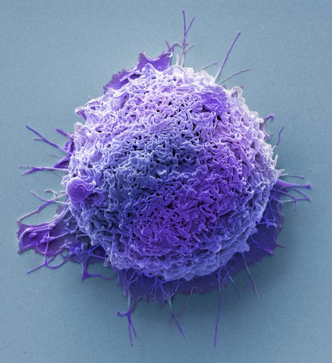 Komórka raka jelita grubego