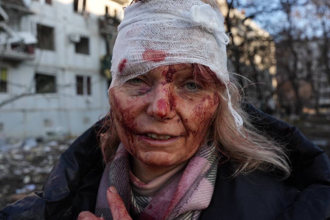 kobieta, która ucierpiała po ataku z powietrzna na cywilną przestrzeń Charkowa, pierwszy dzień inwazji, fot. Wolfgang Schwan/Anadolu Agency via Getty Images