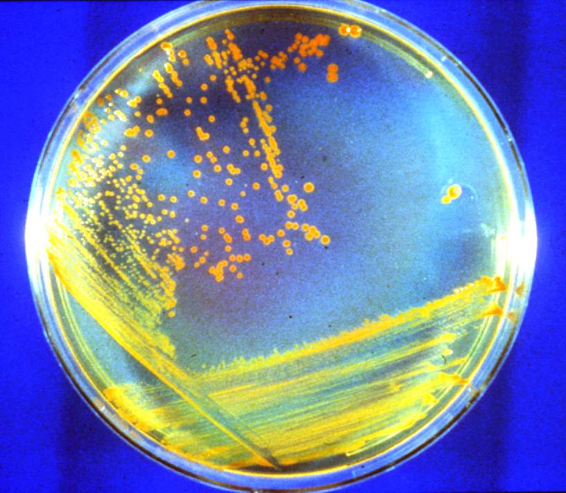 Hodowla bakterii Conana (fot. Michael J. Daly/USU)