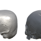 deformacja czaszki