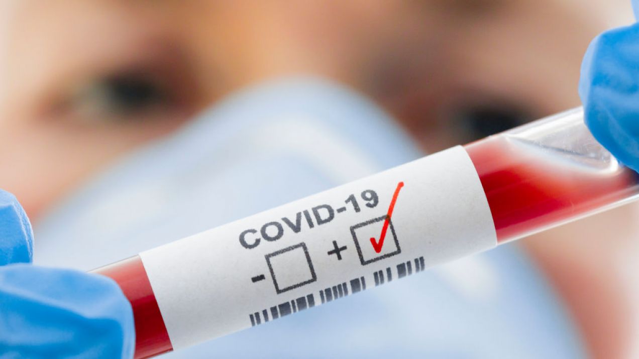 Nowe badania sugerują, że istnieją dwa szczepy koronawirusa (Photo by Thomas Trutschel/Photothek via Getty Images)