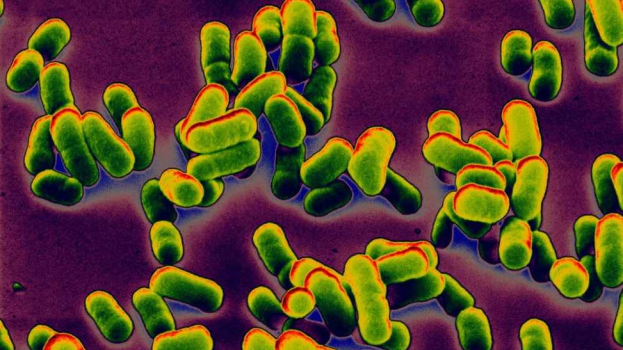 Bakteria Yersinia pestis wywołująca dżumę