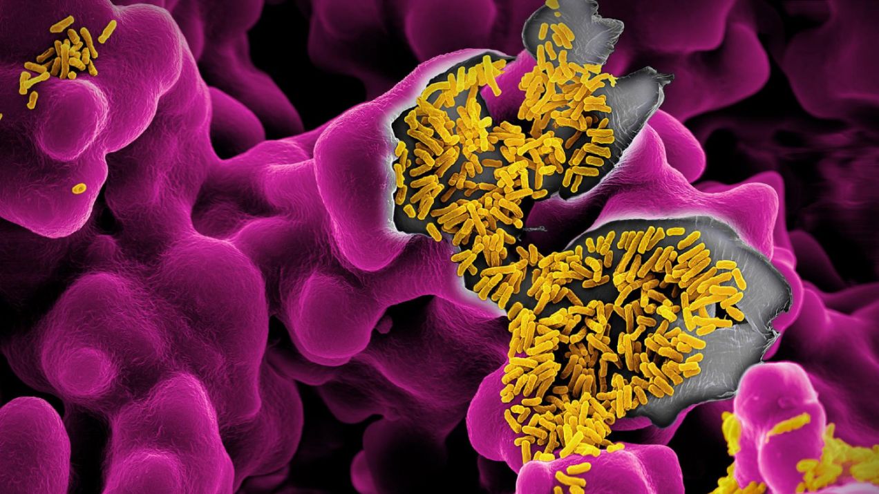 Escherichia coli, żółte pręciki skupione na fioletowym podłożu, mogą powodować zatrucia pokarmowe, ale większość szczepów jest nie tylko nieszkodliwa, ale także pożyteczna (Photographs by Martin Oeggerli)