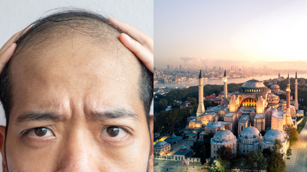 Przeszczep włosów w Turcji. Dzięki wyjazdom połączonym z zabiegiem Stambuł to turystyczny hit